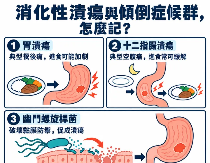 消化性潰瘍與傾倒症候群圖解預覽